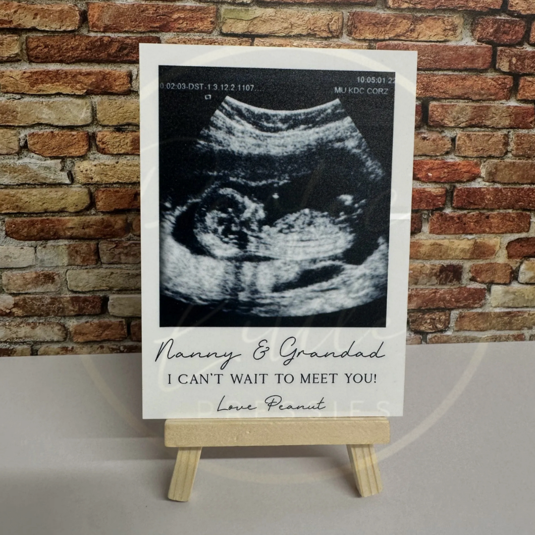 Baby Scan Polaroid Easel